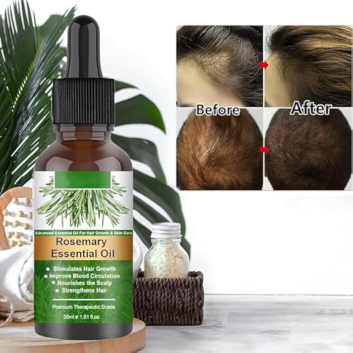 Rosemary Oil for Hair - Unleash your hair's potential with this powerful blend designed to stimulate hair follicle growth, improve scalp condition, and provide long-lasting moisture for dry hair. - Image 2